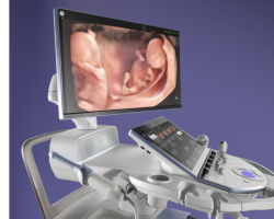 Aparelho de ultrassom fixo portátil ultrassom 5D