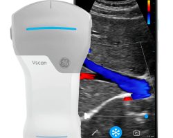 Vscan-Air-Subpage_fundobranco